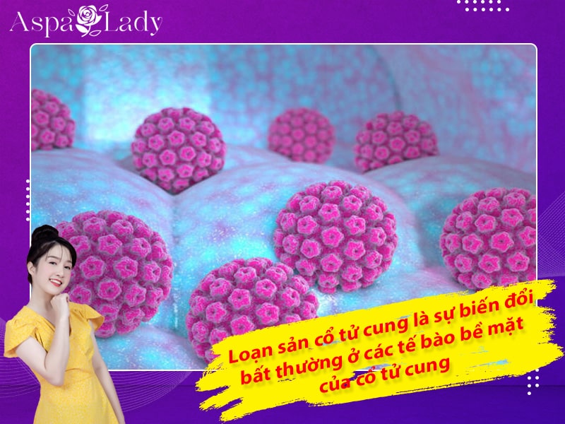 Loạn sản cổ tử cung là sự biến đổi bất thường ở các tế bào bề mặt của cổ tử cung