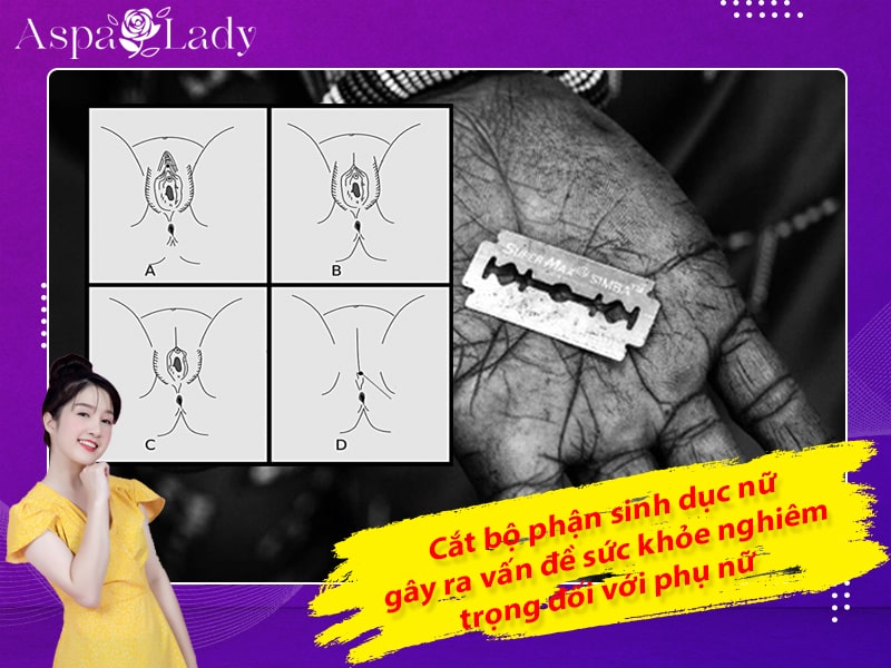 Cắt bộ phận sinh dục nữ gây ra vấn đề sức khỏe nghiêm trọng đối với phụ nữ Cắt bộ phận sinh dục nữ gây ra vấn đề sức khỏe nghiêm trọng đối với phụ nữ