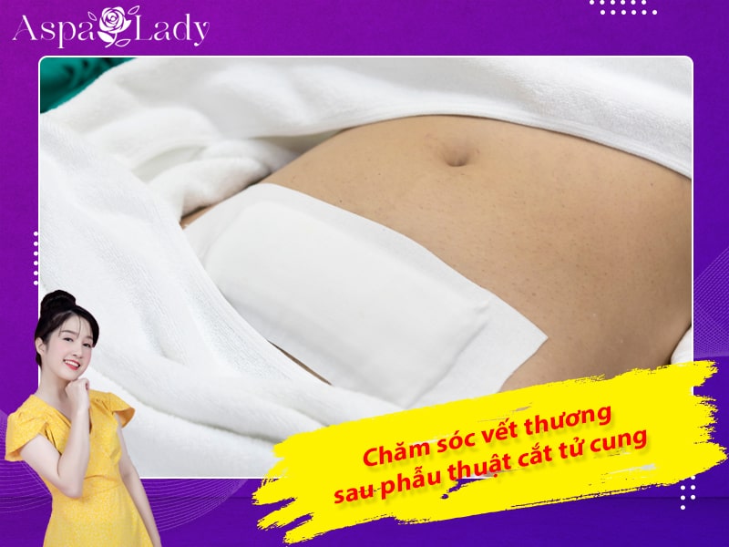 Chăm sóc vết thương sau phẫu thuật cắt tử cung Chăm sóc vết thương sau phẫu thuật cắt tử cung