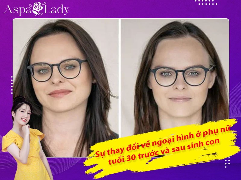 Sự thay đổi về ngoại hình ở phụ nữ tuổi 30 trước và sau sinh con