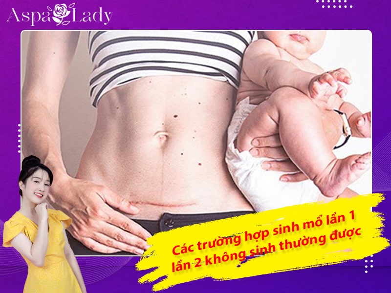 Các trướng hợp sinh mổ lần 1 lần 2 không sinh thường được