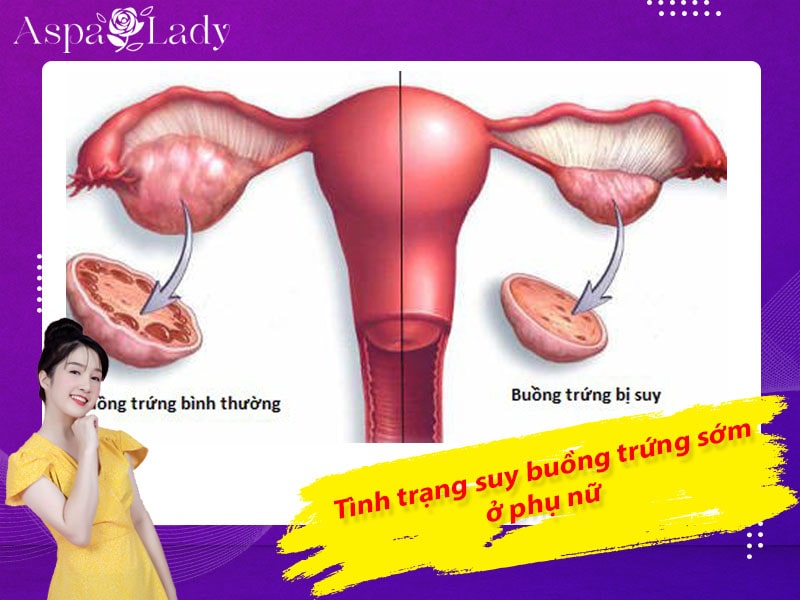 Tình trạng suy buồng trứng sớm ở chị em phụ nữ