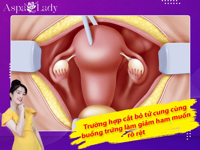 Trường hợp cắt bỏ tử cung cùng buồng trứng làm giảm ham muốn tình dục rõ rệt Trường hợp cắt bỏ tử cung cùng buồng trứng làm giảm ham muốn tình dục rõ rệt