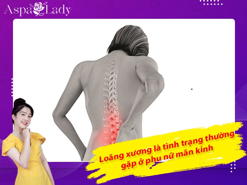 Loãng xương là tình trạng thường gặp ở phụ nữ mãn kinh Loãng xương là tình trạng thường gặp ở phụ nữ mãn kinh