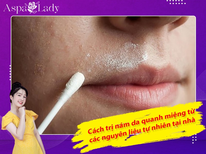 Cách trị nám da quanh miệng từ các nguyên liệu tự nhiên tại nhà