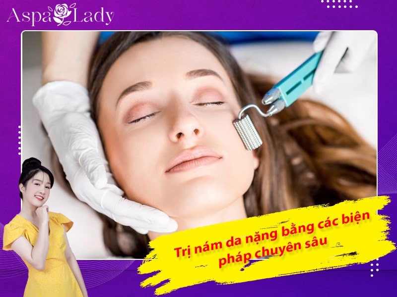 Trị nám da nặng bằng các biện pháp chuyên sâu Trị nám da nặng bằng các biện pháp chuyên sâu