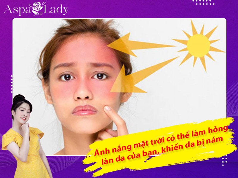 Ánh nắng mặt trời có thể làm hỏng làn da của bạn, khiến da bị nám Ánh nắng mặt trời có thể làm hỏng làn da của bạn, khiến da bị nám