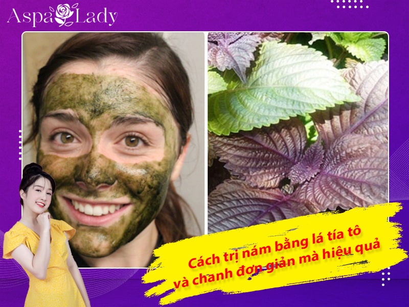 Cách trị nám bằng lá tía tô và chanh đơn giản mà hiệu quả Cách trị nám bằng lá tía tô và chanh đơn giản mà hiệu quả