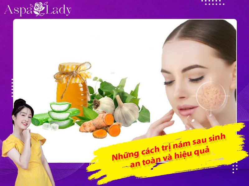 Những cách trị nám sau sinh an toàn và hiệu quả Những cách trị nám sau sinh an toàn và hiệu quả