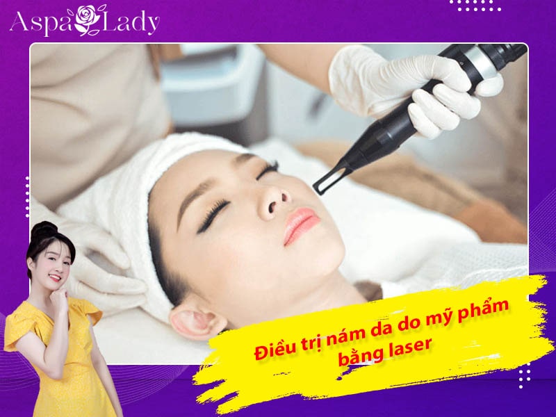 Điều trị nám da do mỹ phẩm bằng laser