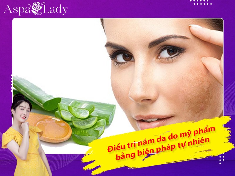 Điều trị nám da do mỹ phẩm bằng biện pháp tự nhiên