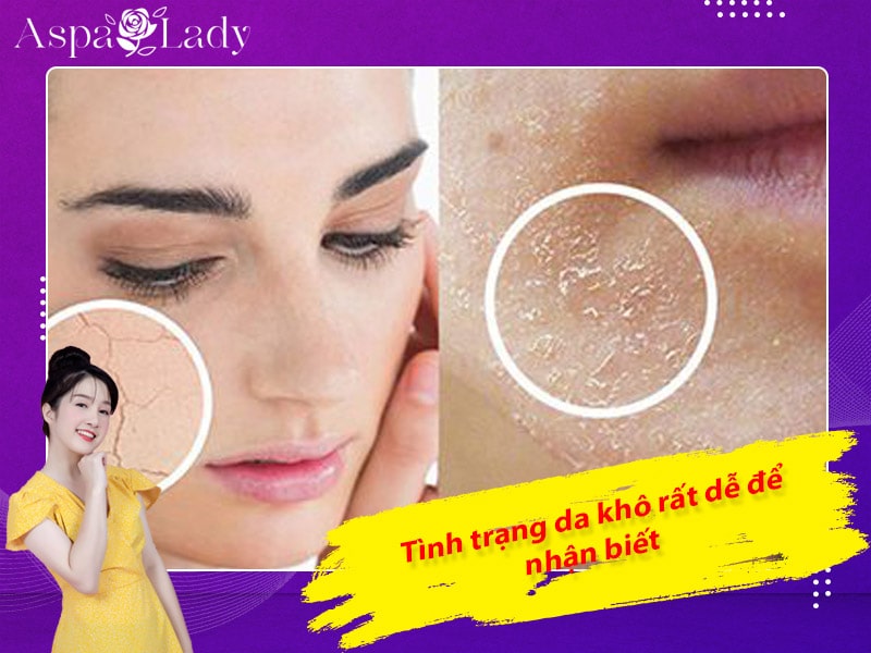 Tình trạng da khô rất dễ để nhận biết Tình trạng da khô rất dễ để nhận biết