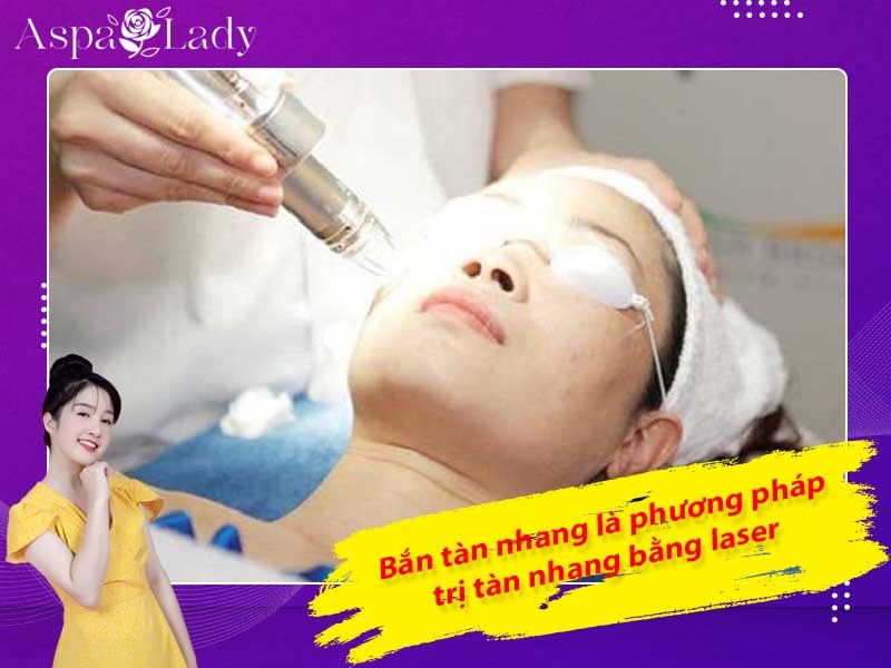 Bắn tàn nhang là phương pháp trị tàn nhang bằng laser Bắn tàn nhang là phương pháp trị tàn nhang bằng laser