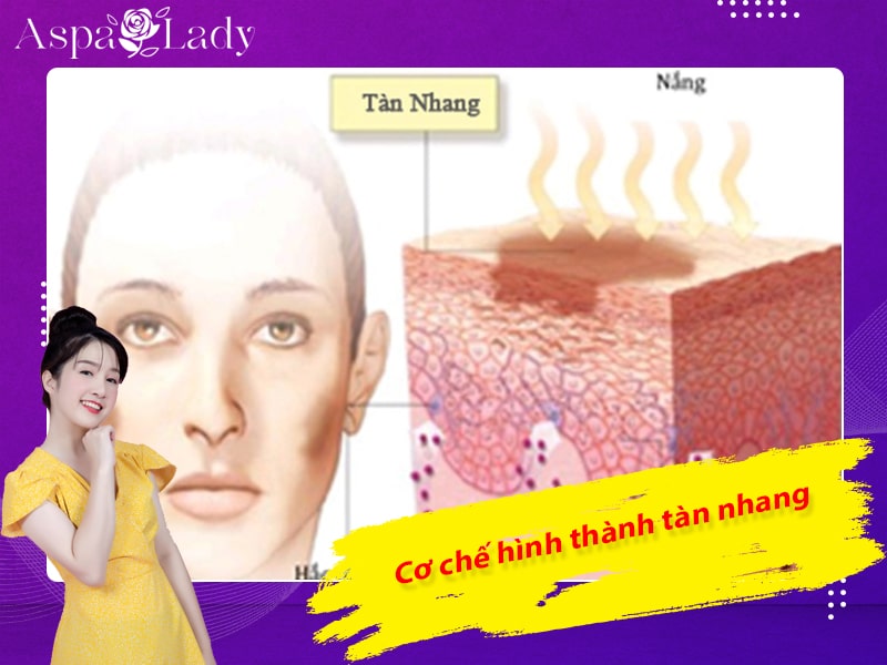Cơ chế hình thành tàn nhang Cơ chế hình thành tàn nhang