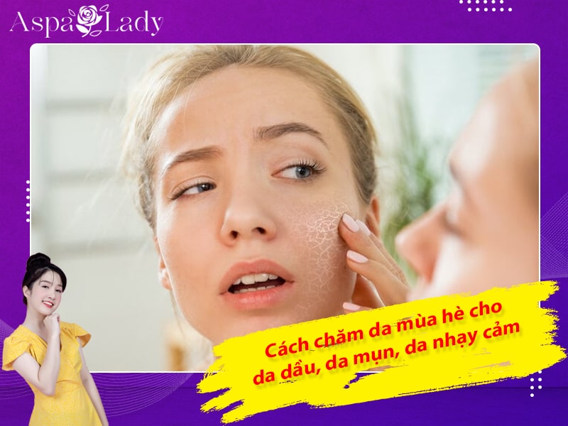 Cách chăm da mùa hè cho da dầu, da mụn, da nhạy cảm