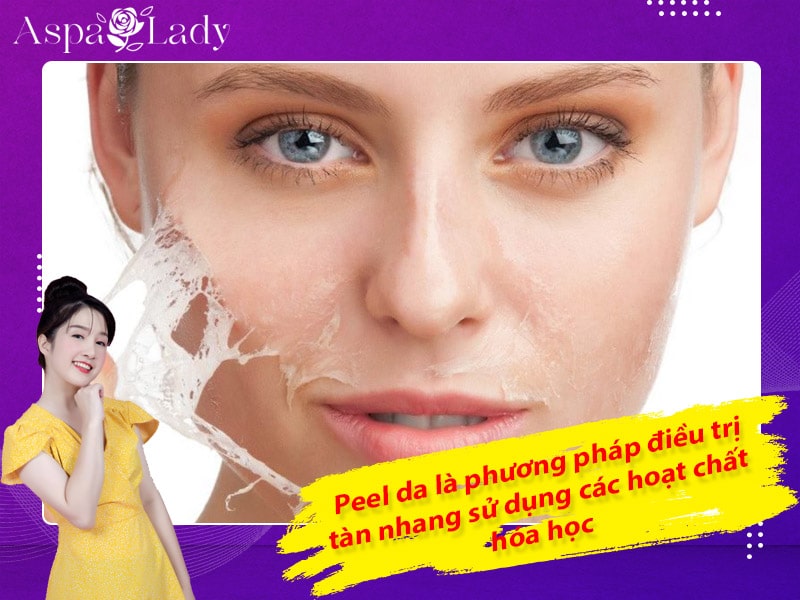 Peel da là phương pháp điều trị tàn nhang sử dụng các hoạt chất hóa học Peel da là phương pháp điều trị tàn nhang sử dụng các hoạt chất hóa học