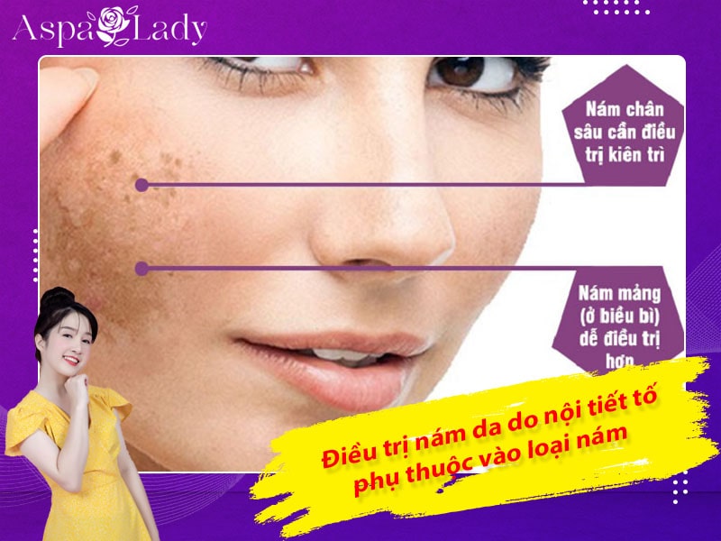 Điều trị nám da do nội tiết tố phụ  thuộc vào loại nám da Điều trị nám da do nội tiết tố phụ  thuộc vào loại nám da