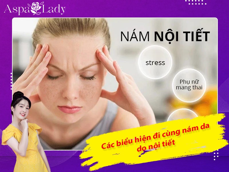 Các biểu hiện đi cùng nám da do nội tiết Các biểu hiện đi cùng nám da do nội tiết