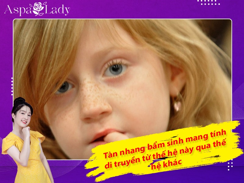 Tàn nhang bẩm sinh mang tính di truyền từ thế hệ này qua thế hệ khác Tàn nhang bẩm sinh mang tính di truyền từ thế hệ này qua thế hệ khác