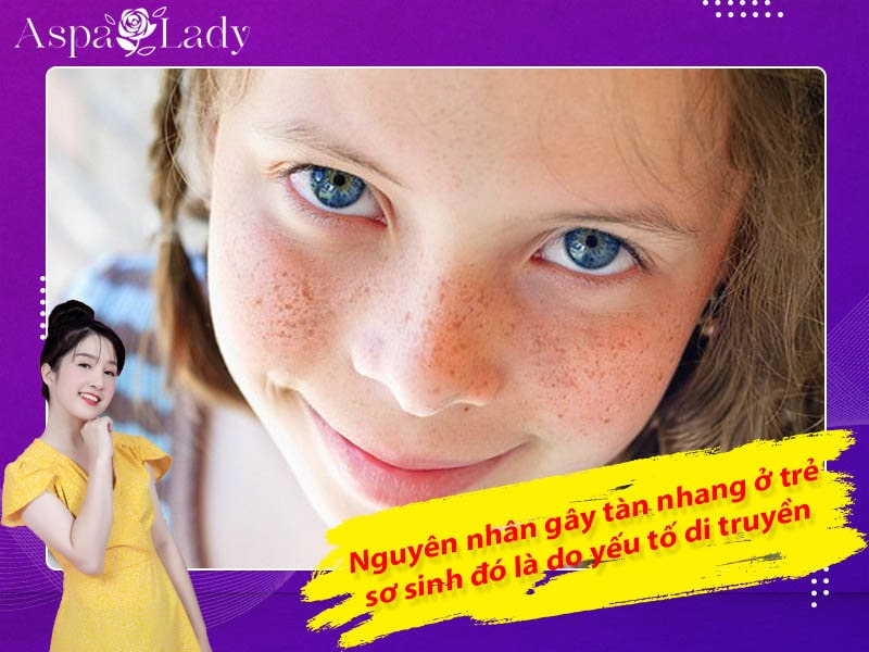 Nguyên nhân gây tàn nhang ở trẻ sơ sinh đó là do yếu tố di truyền Nguyên nhân gây tàn nhang ở trẻ sơ sinh đó là do yếu tố di truyền