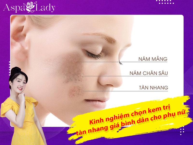 Kinh nghiệm chọn kem trị tàn nhang giá bình dân cho phụ nữ Kinh nghiệm chọn kem trị tàn nhang giá bình dân cho phụ nữ