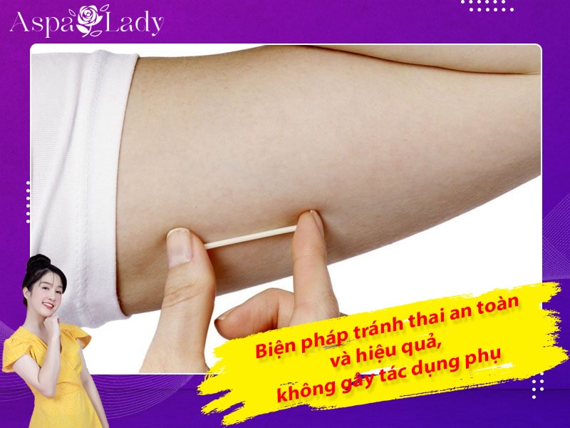 Biện pháp tránh thai an toàn hiệu quả, không gây tác dụng phụ