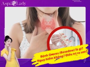 Bệnh Graves (Basedow) là gì? Nguy hiểm không? Điều trị ra sao?