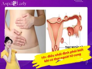 10+ điều nhất định phải biết khi có thai ngoài tử cung