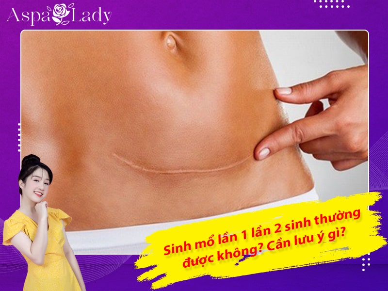 Sinh mổ lần 1 lần 2 sinh thường được không? Cần lưu ý gì?
