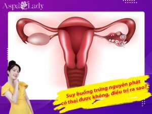 Suy buồng trứng nguyên phát có thai được không, điều trị ra sao?