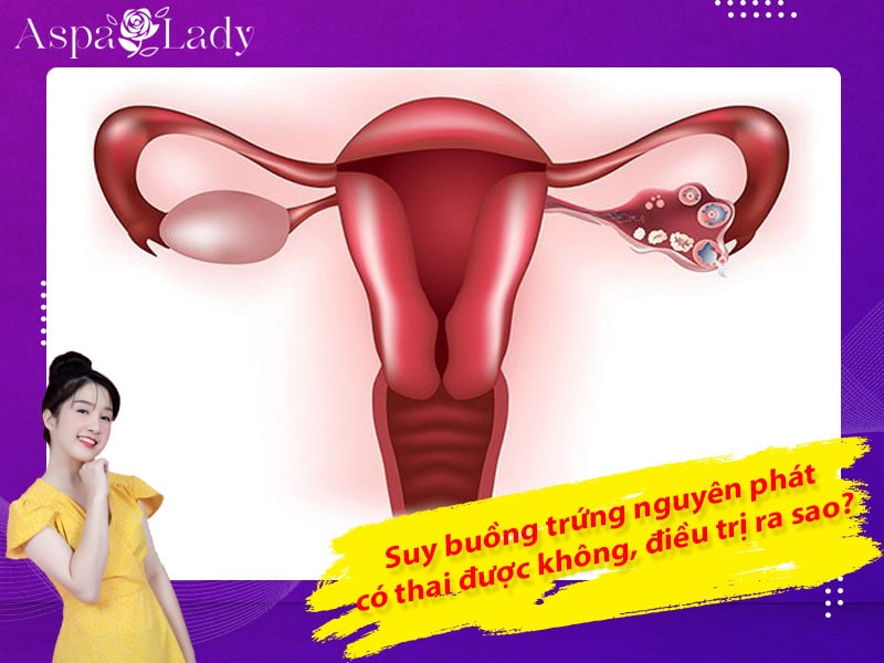 Suy buồng trứng nguyên phát có thai được không, điều trị ra sao?