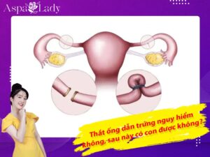 Thắt ống dẫn trứng nguy hiểm không, sau này có con được không?