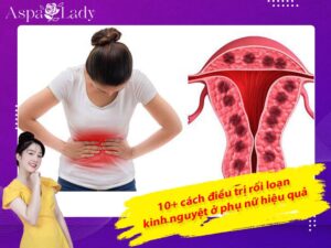 10+ cách điều trị rối loạn kinh nguyệt ở phụ nữ hiệu quả nhất