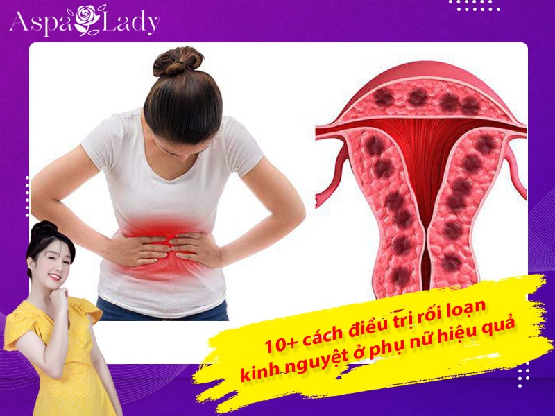 10+ cách điều trị rối loạn kinh nguyệt ở phụ nữ hiệu quả nhất