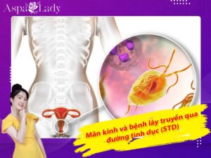 Mãn kinh và bệnh lây truyền qua đường tình dục (STD)