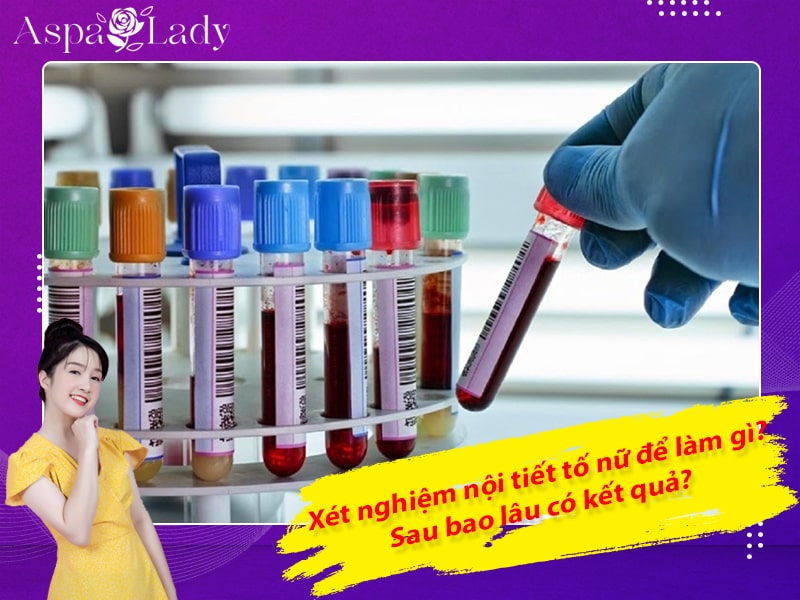 Xét nghiệm nội tiết tố nữ để làm gì? Sau bao lâu có kết quả?