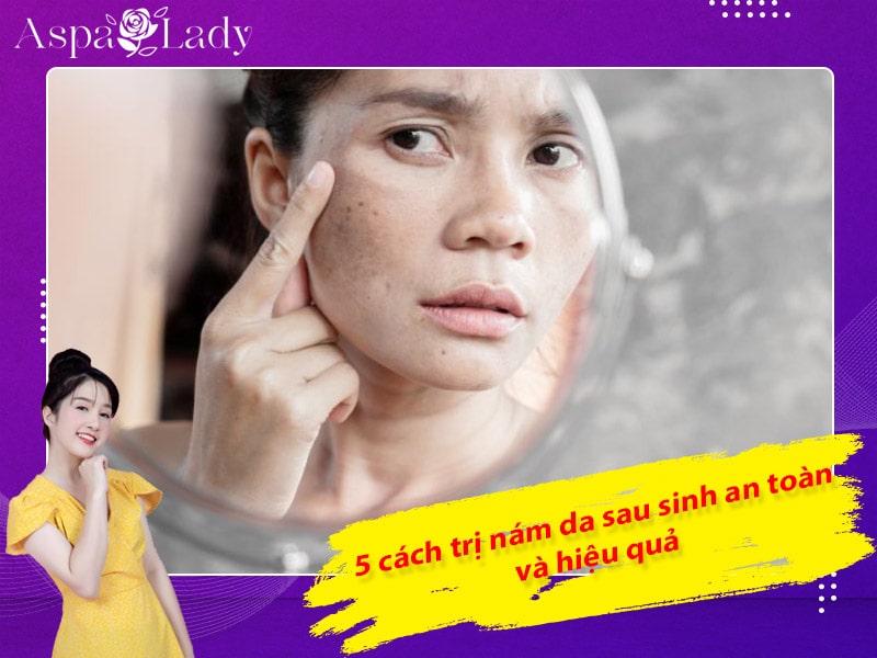 5 cách trị nám da sau sinh an toàn và hiệu quả