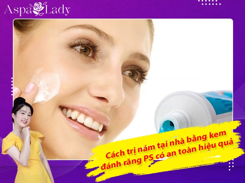 Cách trị nám tại nhà bằng kem đánh răng PS có an toàn hiệu quả?