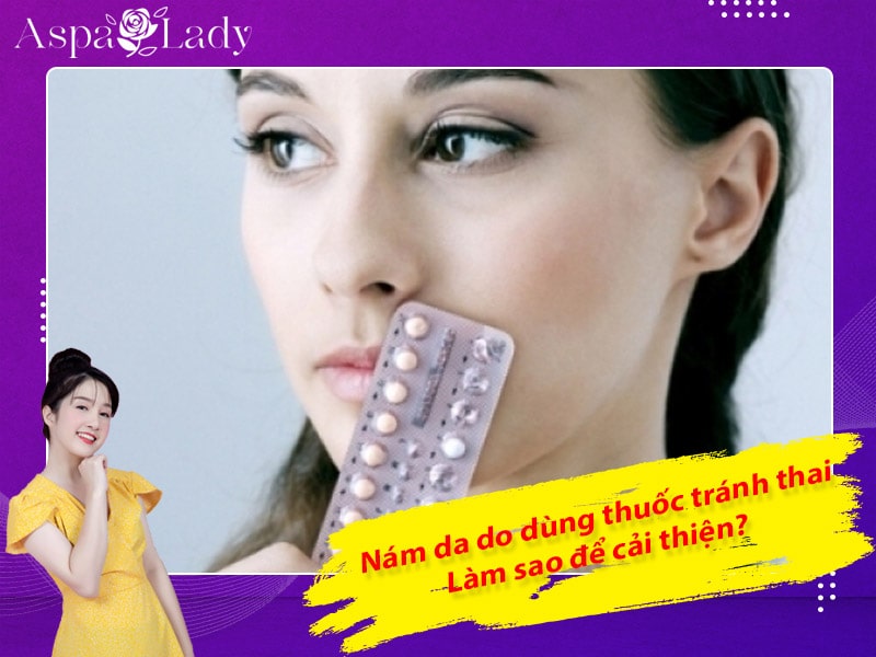 Nám da do dùng thuốc tránh thai: Làm sao để cải thiện?