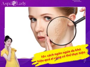 10+ cách ngăn ngừa da khô hiệu quả ai cũng có thể thực hiện