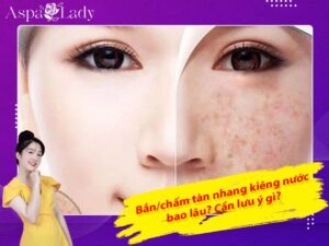 Bắn/chấm tàn nhang kiêng nước bao lâu? Cần lưu ý gì?