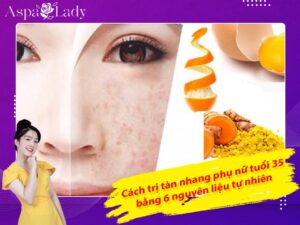 Cách trị tàn nhang phụ nữ tuổi 35 bằng 6 nguyên liệu tự nhiên