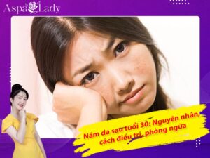 Nám da sau tuổi 30: Nguyên nhân, cách điều trị, phòng ngừa