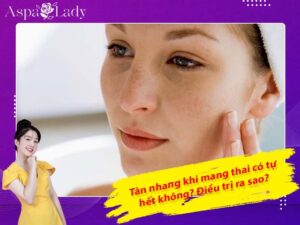Tàn nhang khi mang thai có tự hết không? Điều trị ra sao?