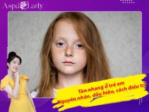 Tàn nhang ở trẻ em: Nguyên nhân, dấu hiệu, cách điều trị