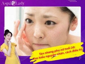 Tàn nhang phụ nữ tuổi 20: Tìm hiểu nguyên nhân và cách điều trị