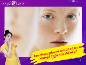Tàn nhang phụ nữ tuổi 25 có lan ra không? Chữa như thế nào?