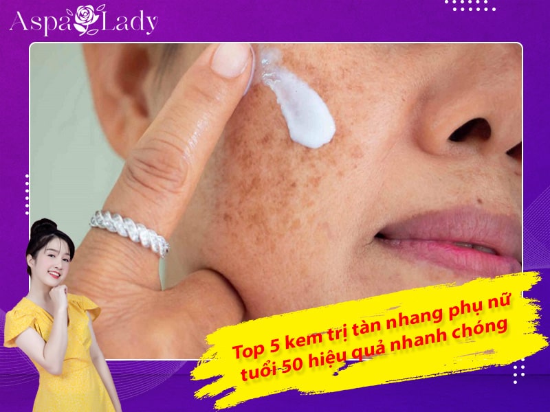 Top 5 kem trị tàn nhang phụ nữ tuổi 50 hiệu quả nhanh chóng