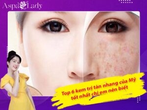 Top 6 kem trị tàn nhang của Mỹ tốt nhất chị em nên biết
