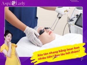 Xóa tàn nhang bằng laser bao nhiêu tiền? Bao lâu hết thâm?